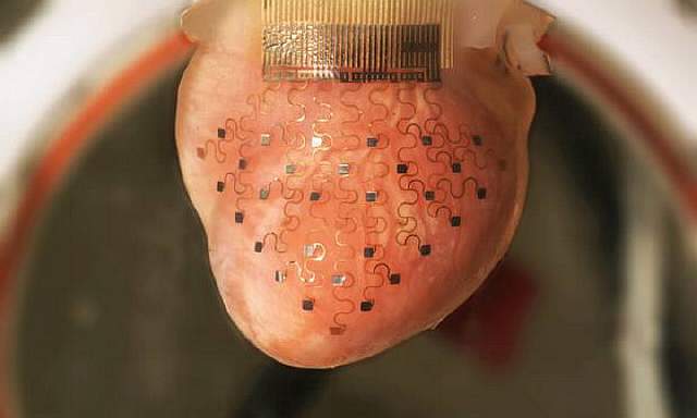 Напечатанная на 3D-принтере электронная «одежда» позволит человеческому сердцу биться вечно  - фото 1