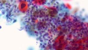 cancer-cells-tracer_1024