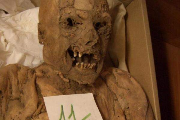 Colon-cancer-gene-mutation-found-in-18th-century-mummy