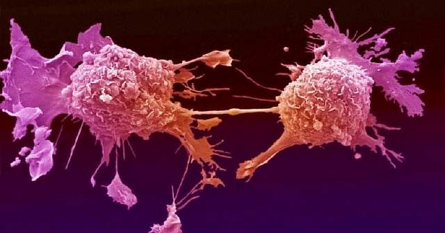 tumor cells
