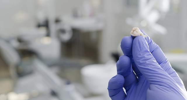 Устройство для "раскалывания" зубов поможет извлекать стволовые клетки