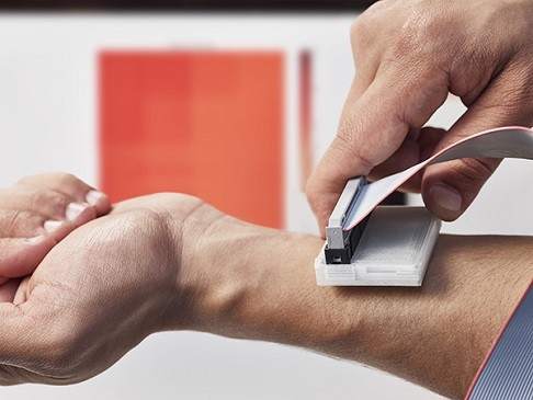 Эффективное недорогое портативное устройство для обнаружения рака кожи получило престижную премию Дайсона