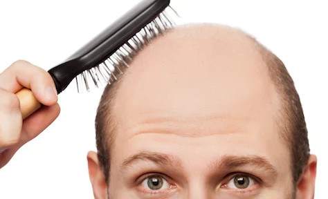 Хорошая новость для лысых: исследователи утверждают, что они создали вещество, вызывающее появление волос