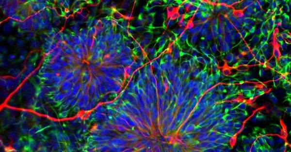 Предложено использовать стволовые клетки плаценты в регенеративной медицине