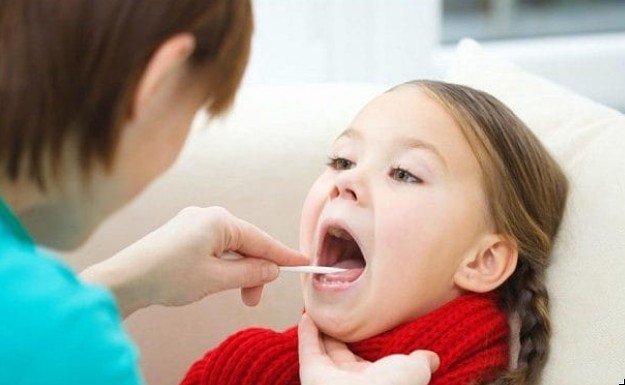 Удаление миндалин в детском возрасте более чем в три раза увеличивает риск развития астмы в дальнейшей жизни
