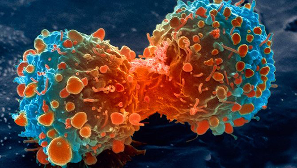 Раскрыт внутриклеточный молекулярный тормоз, предотвращающий развитие рака