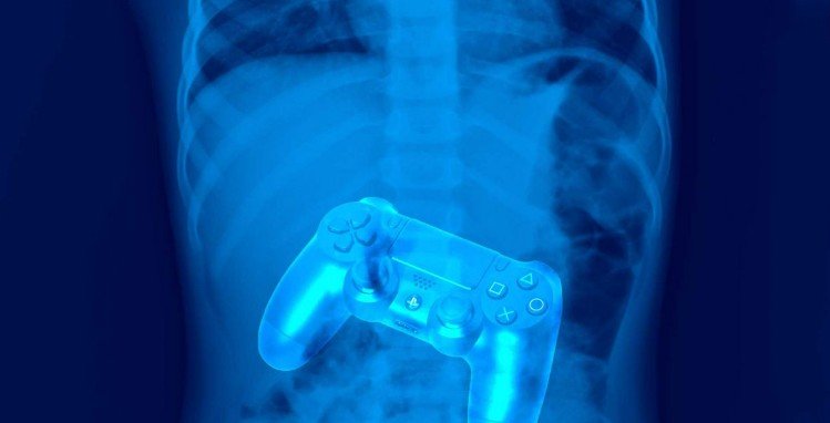 Проглатываемый контроллер перемещает игру с экрана монитора прямо в желудочно-кишечный тракт геймера